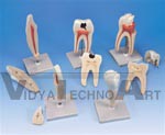 Classic Tooth Model Series, 5 models